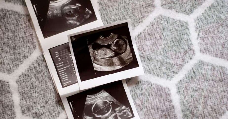 First Trimester Pregnancy Tips for First-time moms. Image of 3 ultrasound photos on a grey rug.