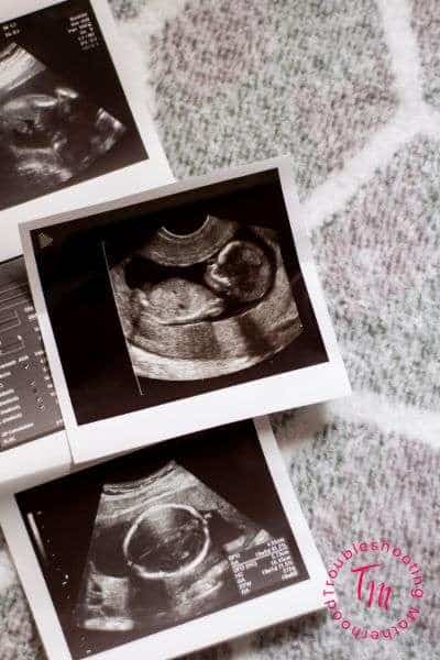 A collection of ultrasound images depicting a developing fetus in the first trimester of pregnancy, situated on a textured background, illustrating key aspects of first trimester pregnancy tips and checklists for new moms.